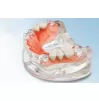 Termoplastinė plastmasė DENTIFLEX